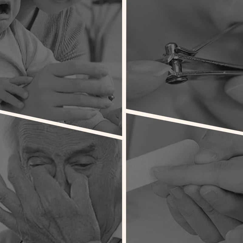 🔥 Medical-Grade Nail Care Device
